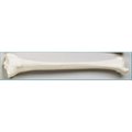 Denoyer-Geppert Anatomical Model, Tibia Bone (Left Side) SB43-S